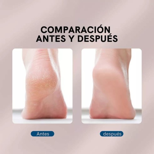 Arquivo de pé elétrico